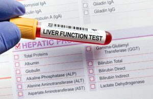 liver function test with sample in vial