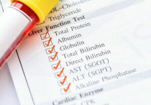 liver function test results