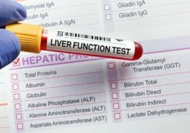 what to know about liver function tests